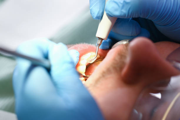 Best Emergency Broken Tooth Repair in Monongah, WV