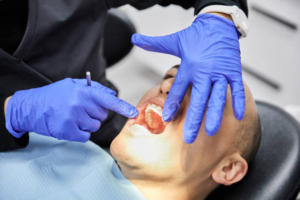 Best Emergency Tooth Extraction in Monongah, WV