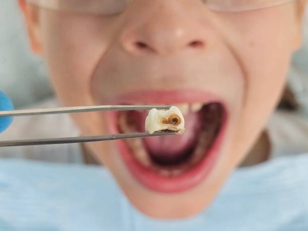 Best Emergency Treatment for Toothache in Monongah, WV